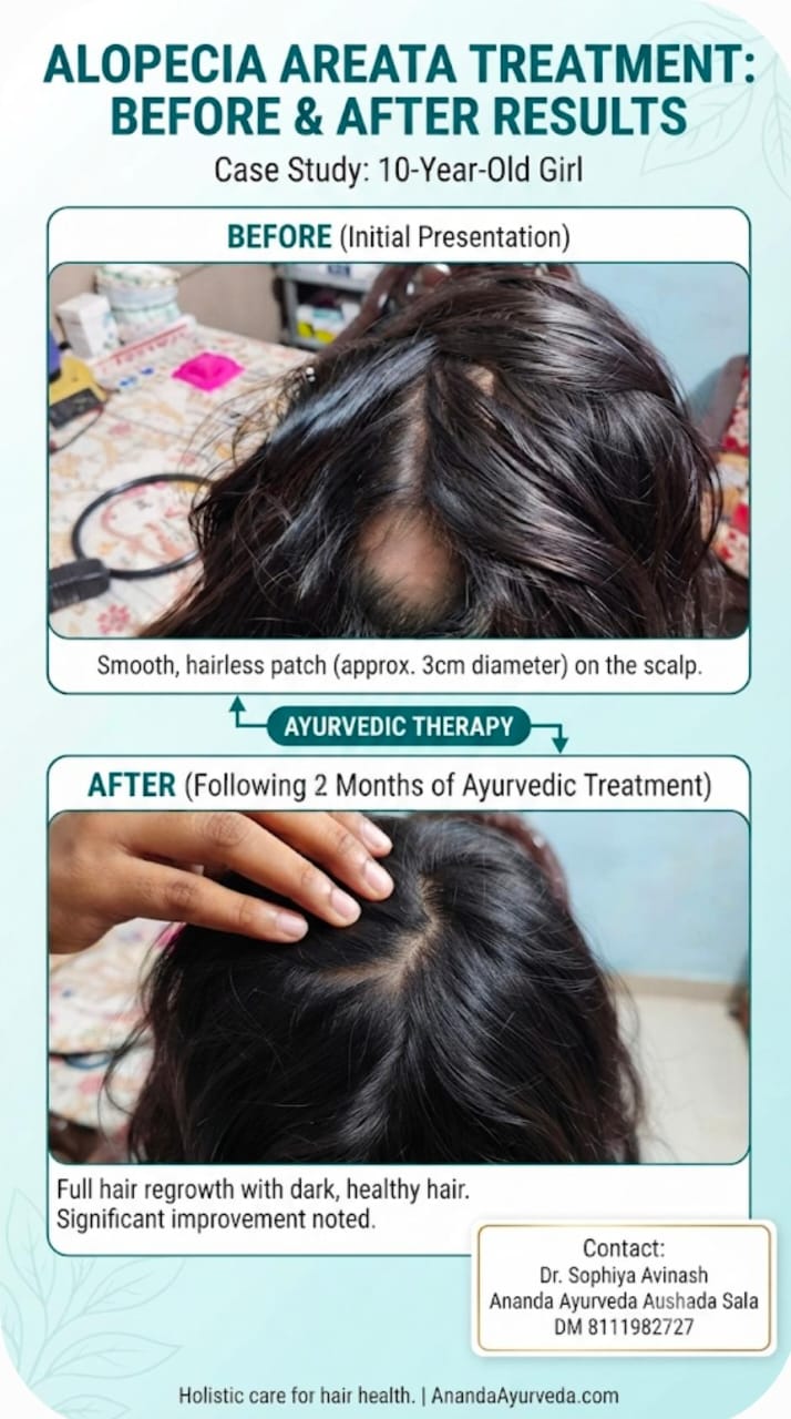 Alopecia areata treatment before-and-after results